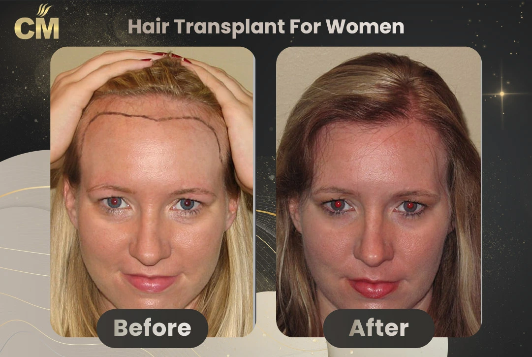 Before and After Result