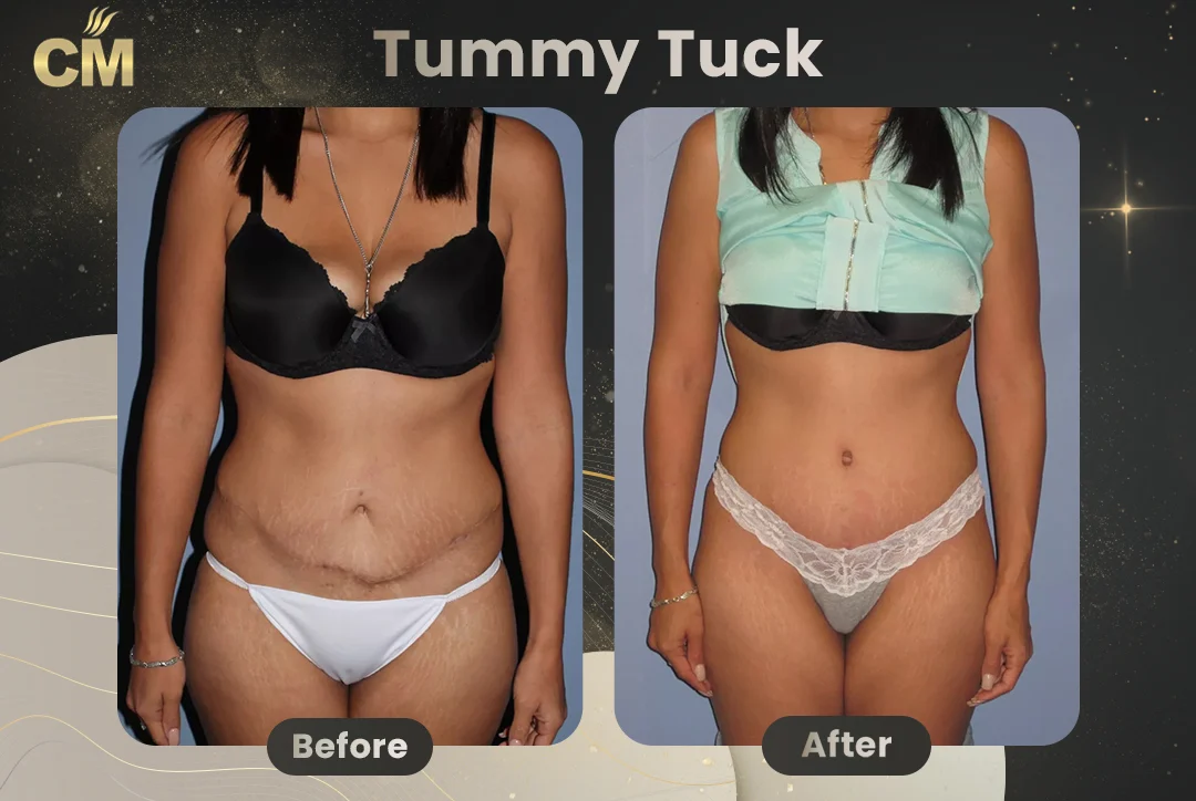 Before and after case 1