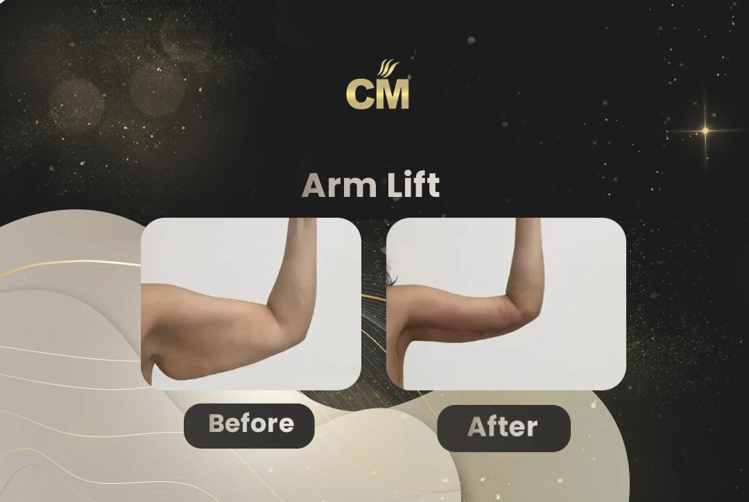 Before and after case 2