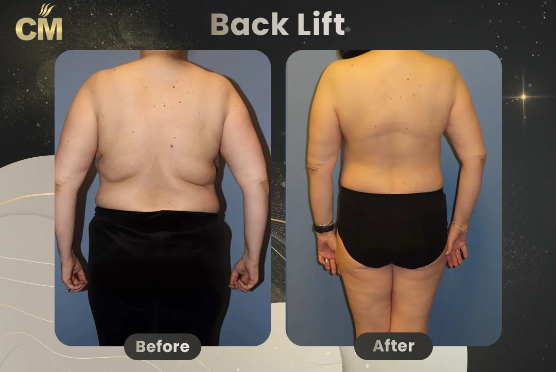 Before and after case 3